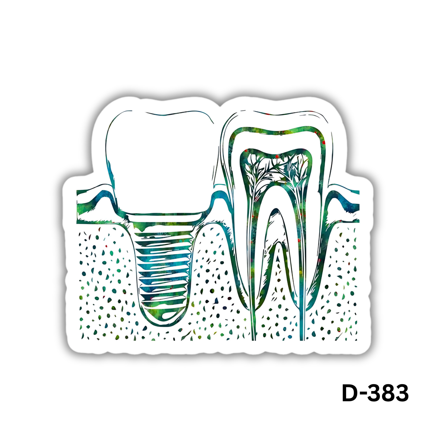 Dental Implant sticker(D-383)